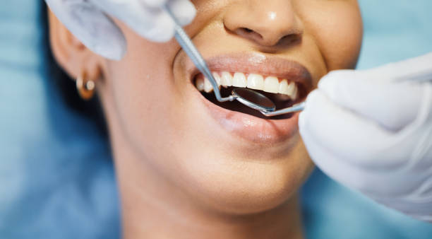 Teeth Whitening in NY